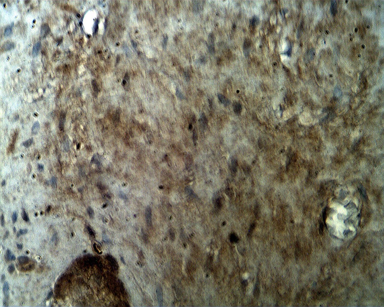 Staining of normal human colorectal tissue with CRFR1 antibody (Cat. No. X2726P) at 2 µg/ml.